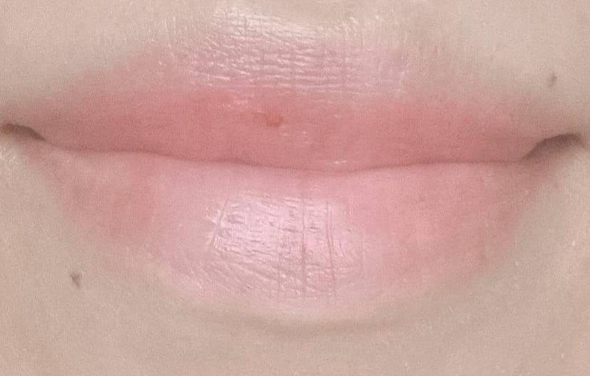Final result of lipstick tattoo at four months showing natural peach lip colour