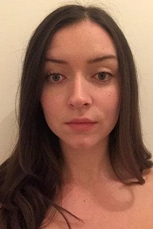 Allanah's skin after one week — reduced redness, smaller pores, glowy finish