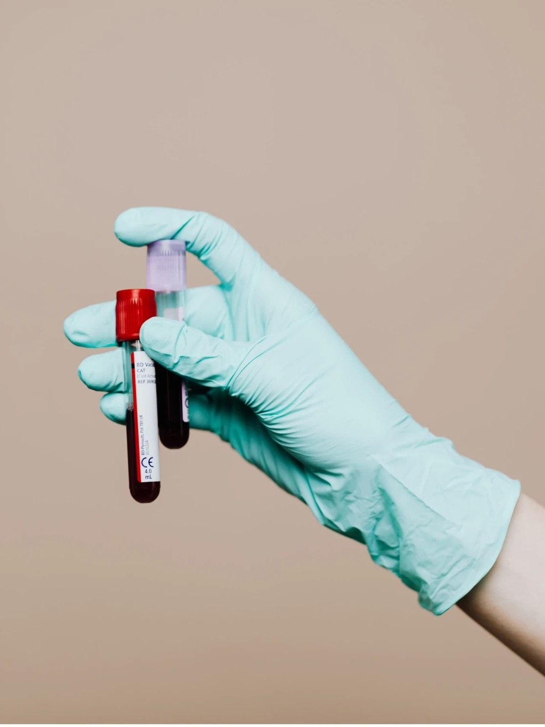 A gloved hand holding two blood collection tubes, one with a red cap and one with a lilac cap, against a beige background