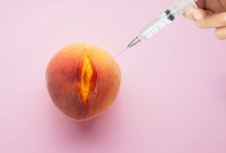 Labia filler injections femsculpt kafali
