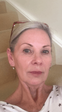 Elizabeth Jensen Derm