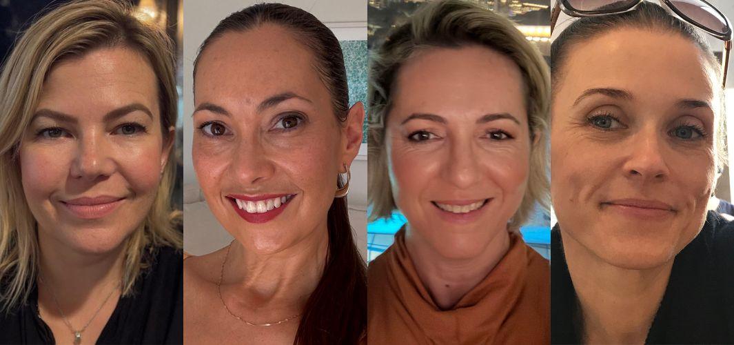 Système Bio+ Oil Serum reader trial before and after skin comparison photos