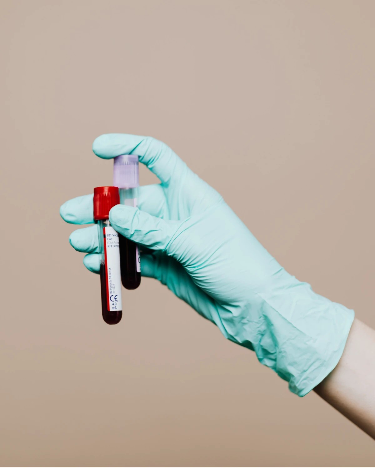 A gloved hand holding two blood collection tubes, one with a red cap and one with a lilac cap, against a beige background