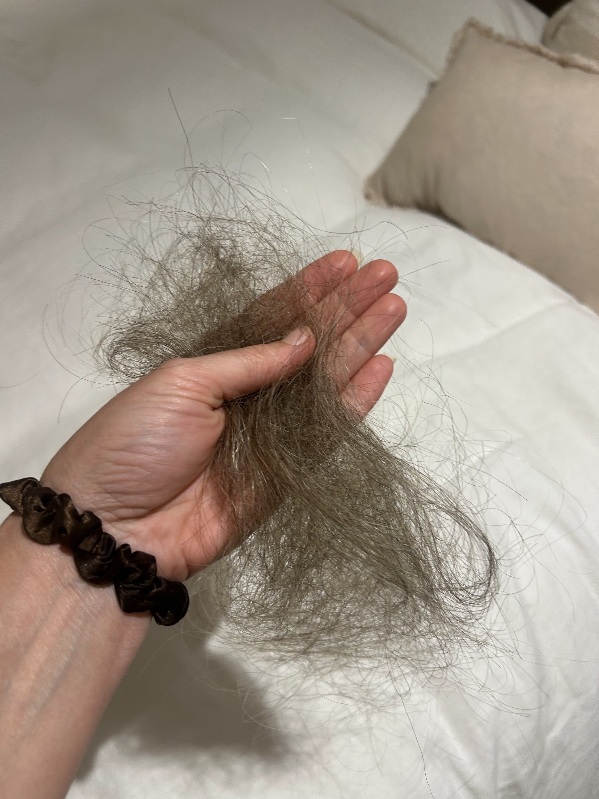 A large clump of hair loss held in Colette's hand over white bedding, a silk scrunchie on her wrist